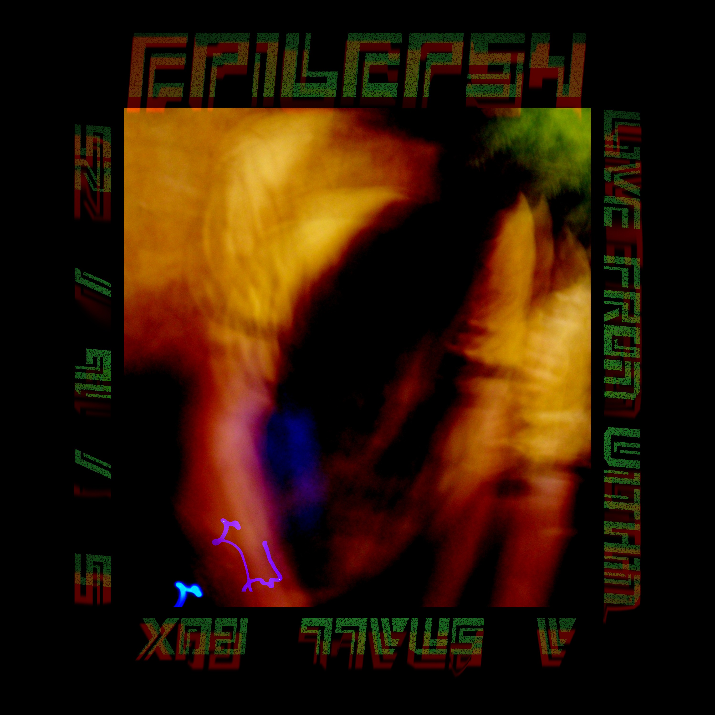Epilepsy - Live From Within a Small Box 5/16/25